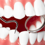 Shortage of orthodontic specialists Nigeria