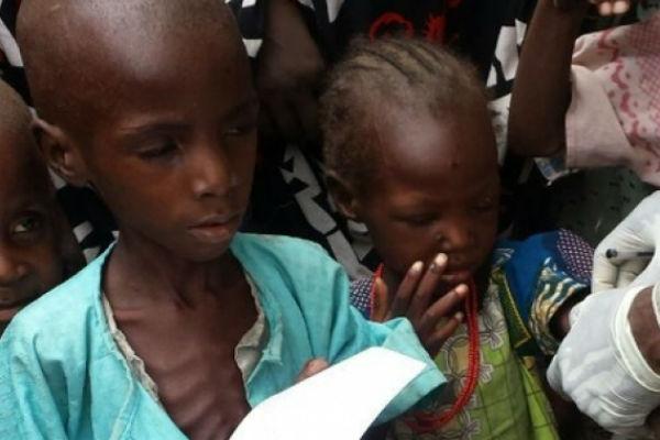 Malnourished Children