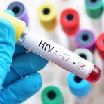 HIV testing