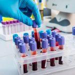 disease diagnostics