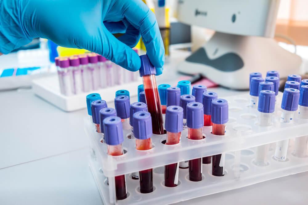 disease diagnostics