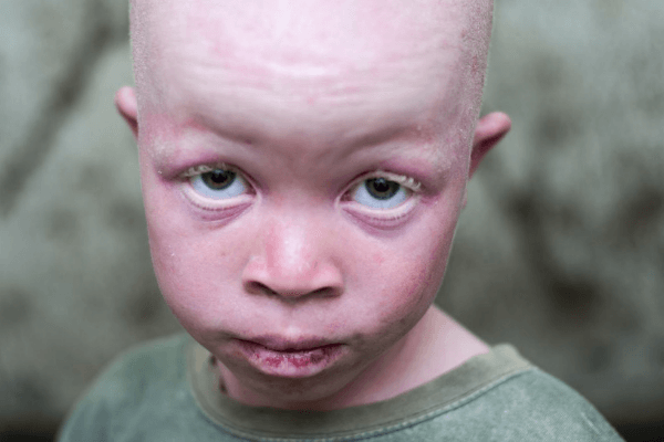 White Ebony exhibition