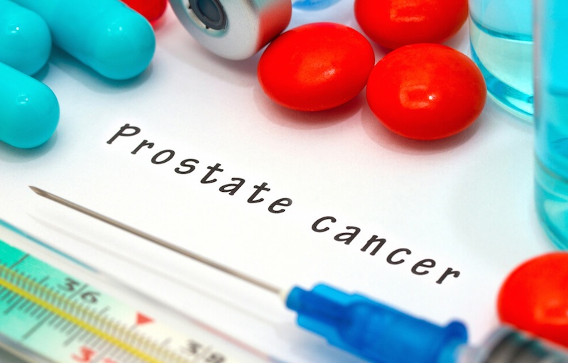 Many Nigerian men ignorant of prostate cancer risk