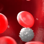 sickle cell anemia