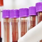 Diagnostic tests for tuberculosis, hepatitis, HPV included in global access program- Roche