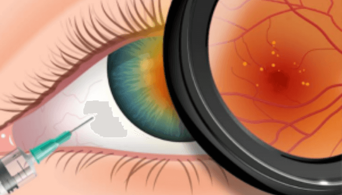 World Sight Day 2024