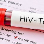 HIV
