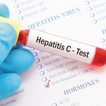 NGO calls for insurance coverage for treatment of Hepatitis in Nigeria