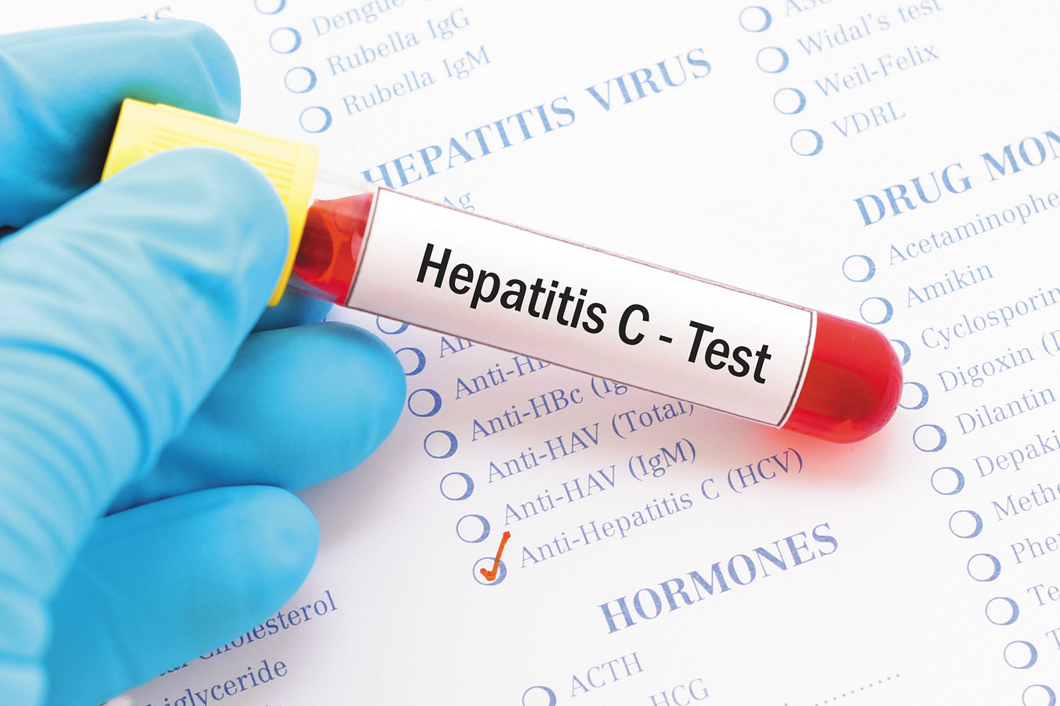 NGO calls for insurance coverage for treatment of Hepatitis in Nigeria
