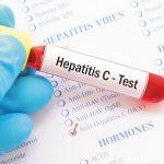 Kwara commences hepatitis screening