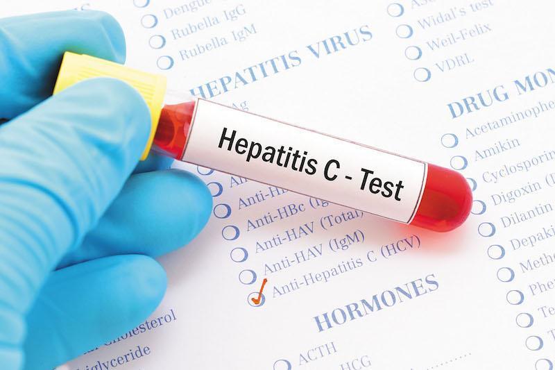 Kwara commences hepatitis screening