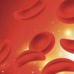 sickle cell disease