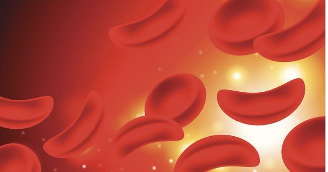 sickle cell disease