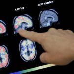 Alzheimer’s drug revival gives hope to millions — and investors