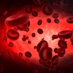 sickle cell