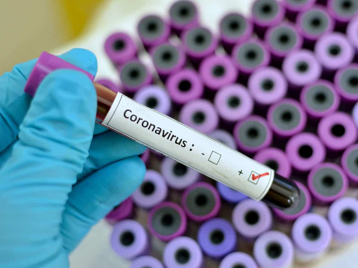 Coronavirus: Buhari approves N71M to scale up surveillance at port health services