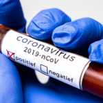 FG begins contact tracing of possible Coronavirus cases, vows to curb further spread