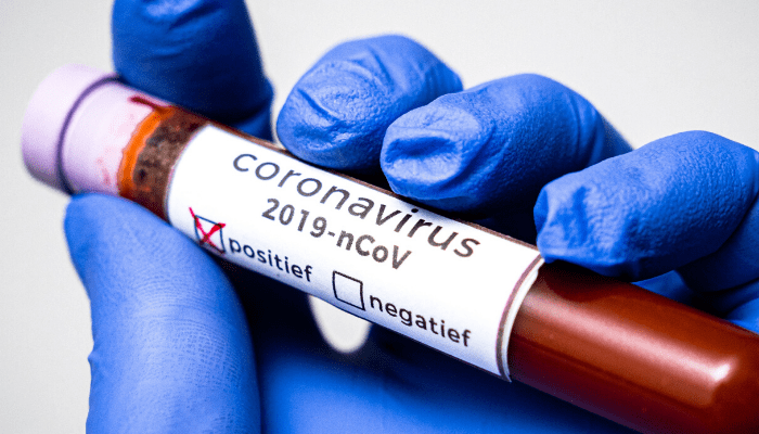 FG begins contact tracing of possible Coronavirus cases, vows to curb further spread