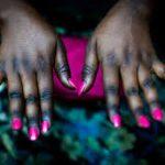 The skin bleaching epidemic in Nigeria: issues, treatment and self care