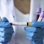 Lagos tests 25 people per day for coronavirus, says Committee chairman