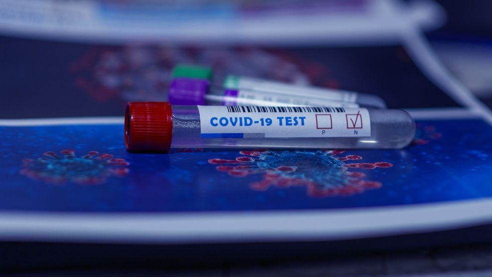 COVID-19 test kits