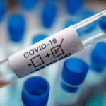 Covid-19 test result