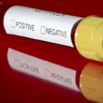 CONVID-19: Varsity don, Badaki says Nigeria missed opportunity for early containment