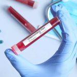 UBTH Commences testing for Covid-19, as NCDC gives approval