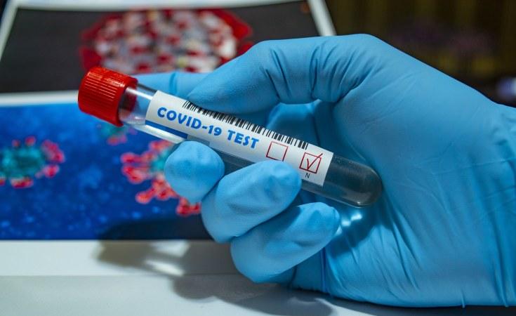 Covid-19: Lagos Biobank handles over 5,000 private testing requests