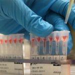 coronavirus vaccines