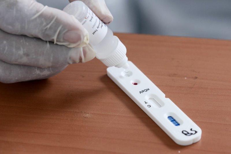 Covid-19: CFL, British partner launch 'fast result-oriented' test kit Wednesday