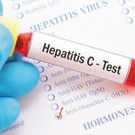 Hepatitis Test