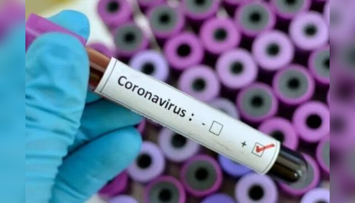 Lagos confirms COVID19 infection in a private school