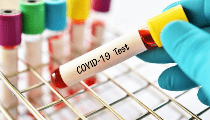 "test tube with COVID-19 Test written on it"