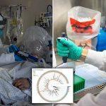 First coronavirus reinfection case with severe symptoms confirmed