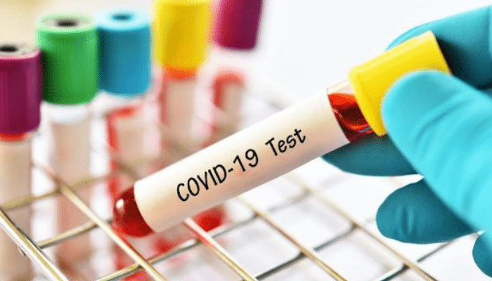 NCDC denies fraud allegations over COVID-19 test for air travelers