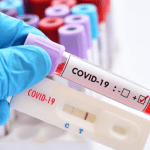 Covid-19 test