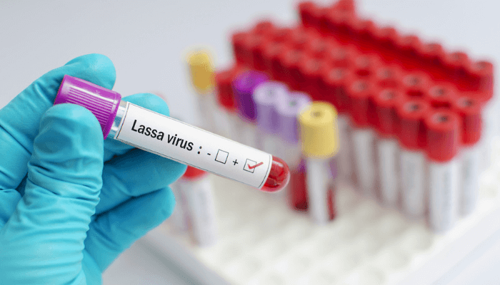 Lassa fever vaccine