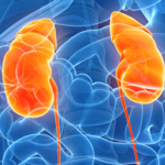 Kidney failure