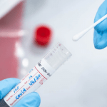COVID-19 test