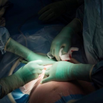 Cesarean Deliveries