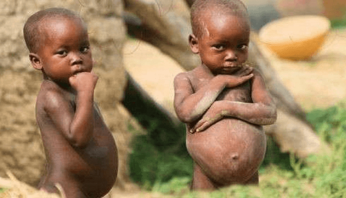 Malnourished children