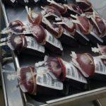 blood transfusion