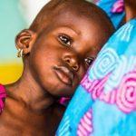 tackling malnutrition in Nigeria