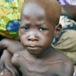 malnutrition in Nigeria