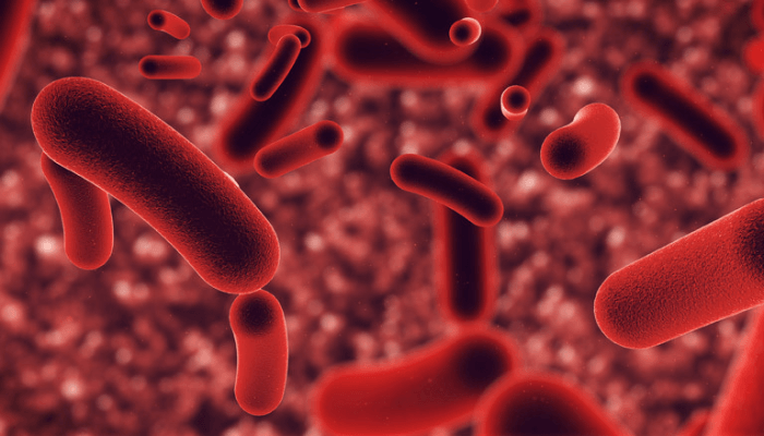 Tuberculosis in Nigeria