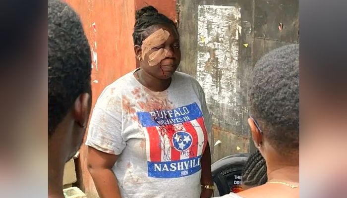 Jennifer Edifi, a victim of election violence in Lagos state