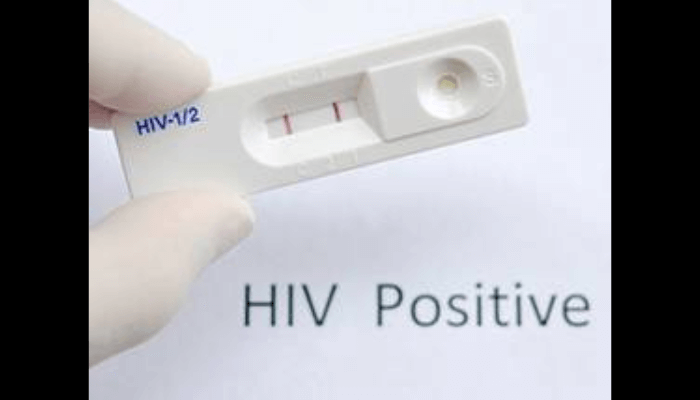 HIV infection in Nigeria