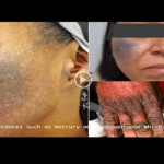 Fair skin at the cost of people’s health