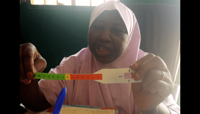 Child Malnutrition in nigeria